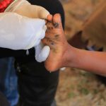 Free-Medical-Camp-in-Mt.-Elgon-Sub-County_72