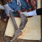Free-Medical-Camp-in-Mt.-Elgon-Sub-County_c12
