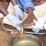 Free-Medical-Camp-in-Mt.-Elgon-Sub-County_c50