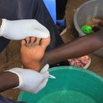 Free-Medical-Camp-in-Mt.-Elgon-Sub-County_e9